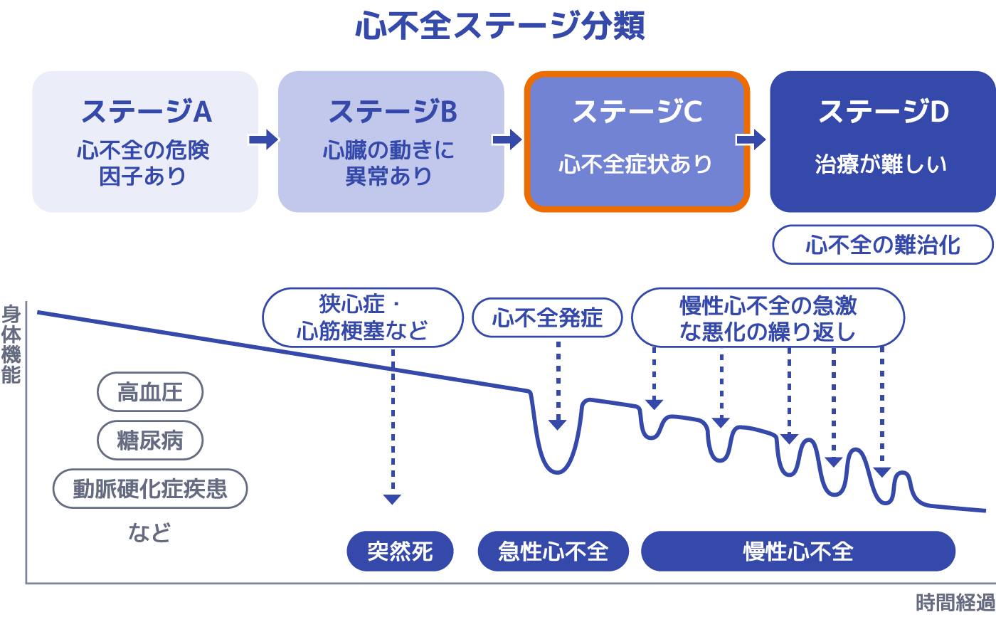 心不全ステージ分類
